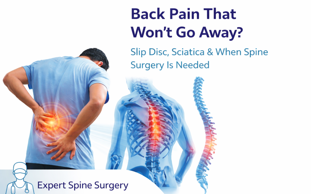 Back Pain That Won’t Go Away? Slip Disc, Sciatica & When Spine Surgery Is Needed in Kopar khairane