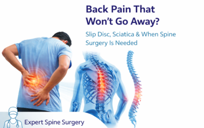 Back Pain That Won’t Go Away? Slip Disc, Sciatica & When Spine Surgery Is Needed in Kopar khairane