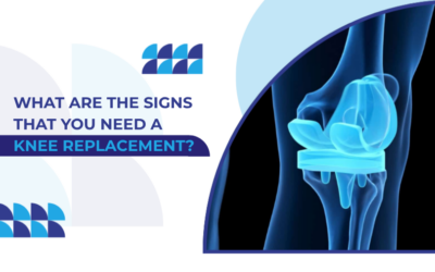 Signs You Need a Knee Replacement