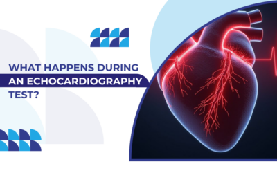 What Happens During an Echocardiography Test?