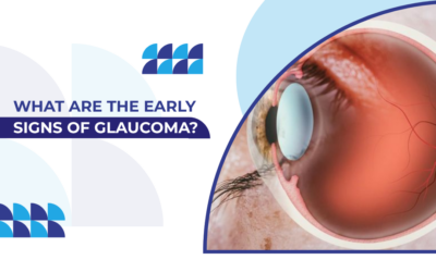 What Are the Early Signs of Glaucoma?