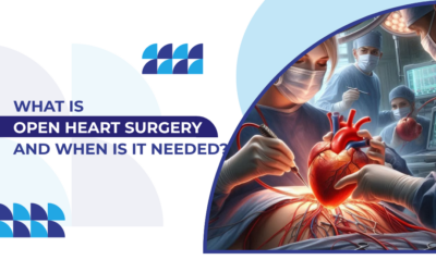 What Is Open Heart Surgery and When Is It Needed?