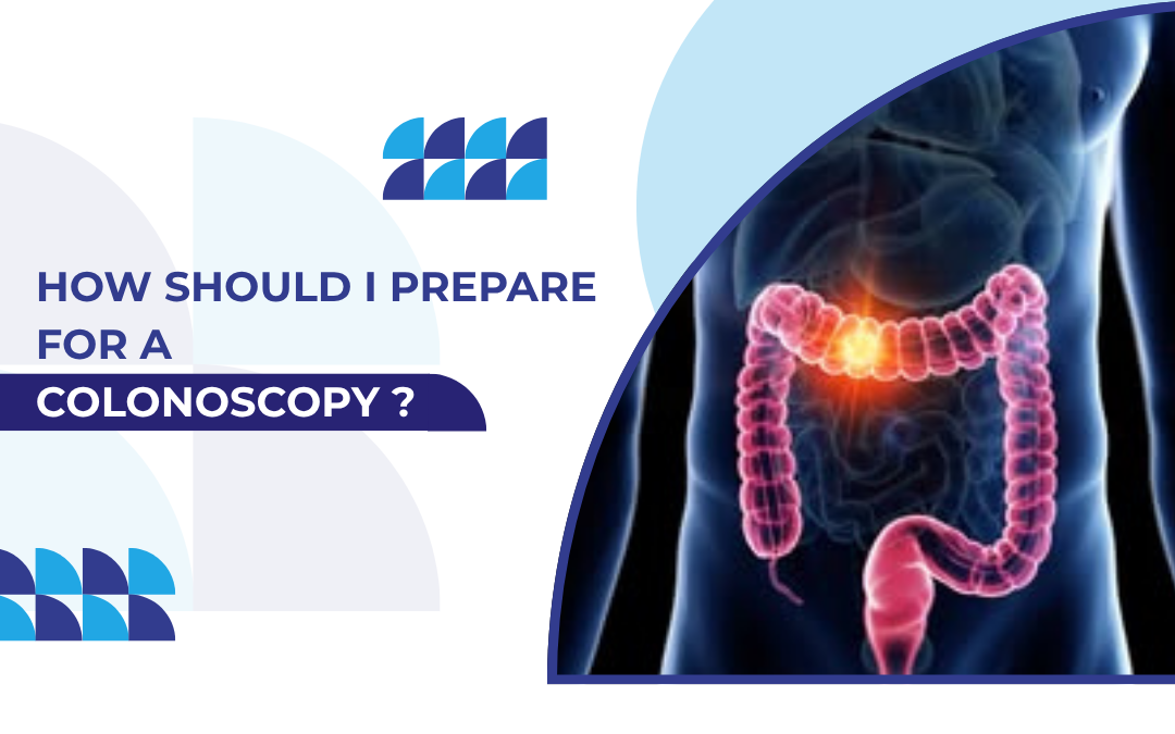 Hero image for a medical article about colonoscopy prep, with a highlighted colon on the right and blue geometric shapes with the title on the left.