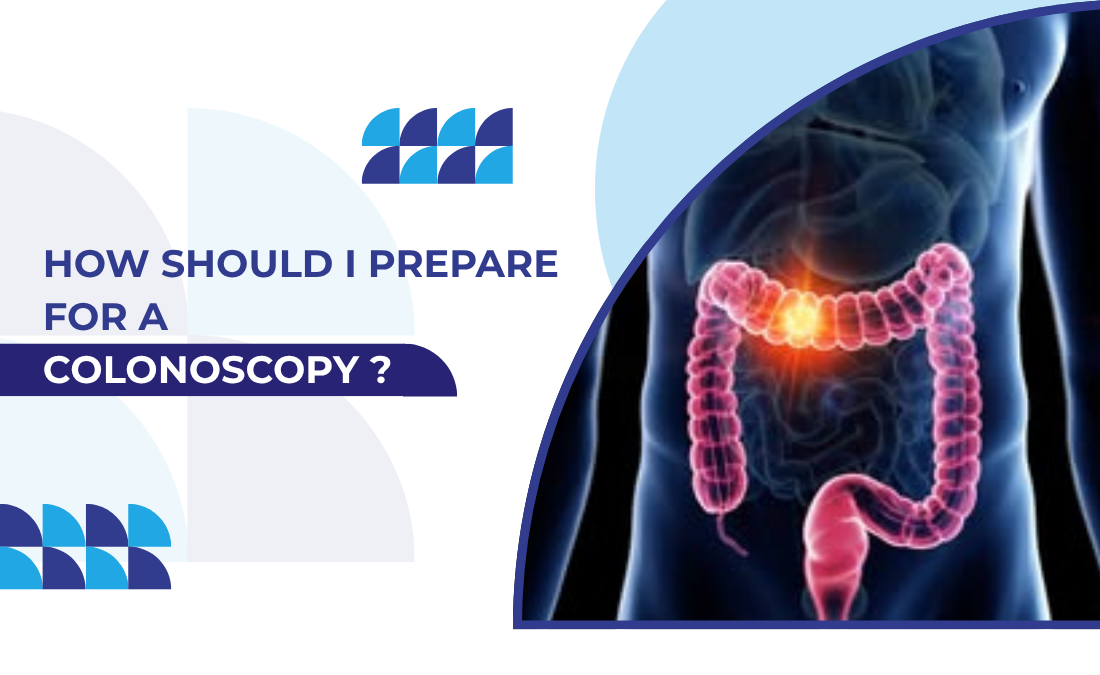 How Should I Prepare for a Colonoscopy?