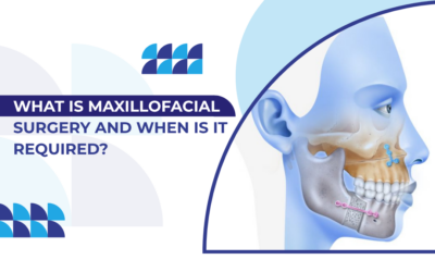 What Is Maxillofacial Surgery and When Is It Required?