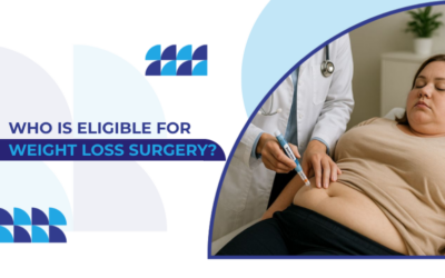 Weight Loss Surgery Eligibility: Who Qualifies and What to Expect