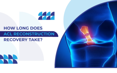 ACL Reconstruction Recovery: A Complete Timeline for Patients