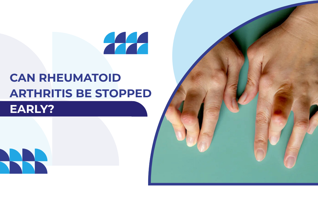 Can rheumatoid arthritis be stopped early? Learn about early diagnosis, treatment, and joint care at Echelon Hospital.