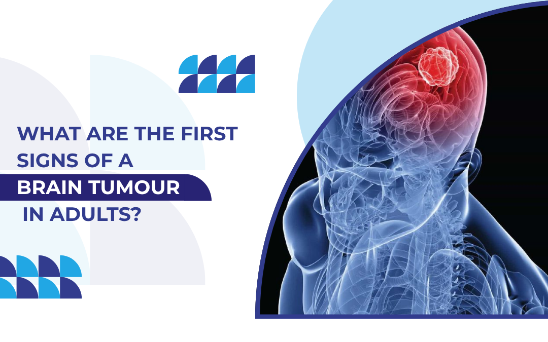 What Are the First Signs of a Brain Tumour in Adults?
