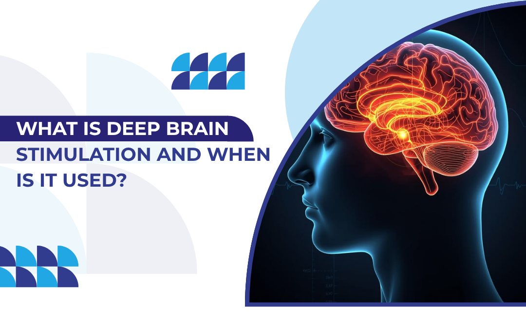 What Is Deep Brain Stimulation and When Is It Used?