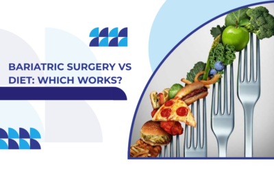 Bariatric Surgery vs Diet: Which Works?