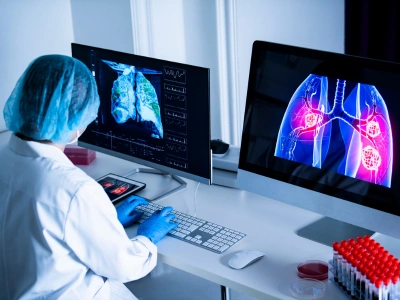 Medical professional in a white coat and blue cap reviews lung CT images on two computer monitors at a diagnostic workstation.