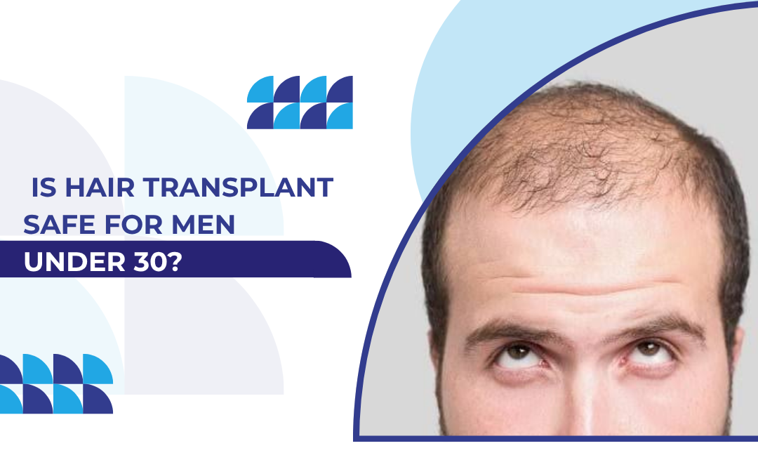 Is Hair Transplant Safe for Men Under 30?