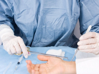Surgeon in blue scrubs and gloves performing hand surgery, using forceps and a scalpel on a patient’s hand near a sterile drape.