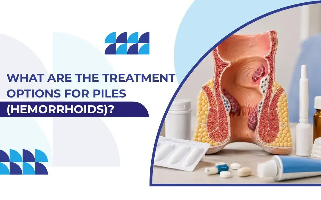What Are the Treatment Options for Piles (Hemorrhoids)?