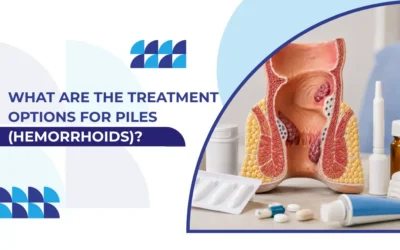 What Are the Treatment Options for Piles (Hemorrhoids)?