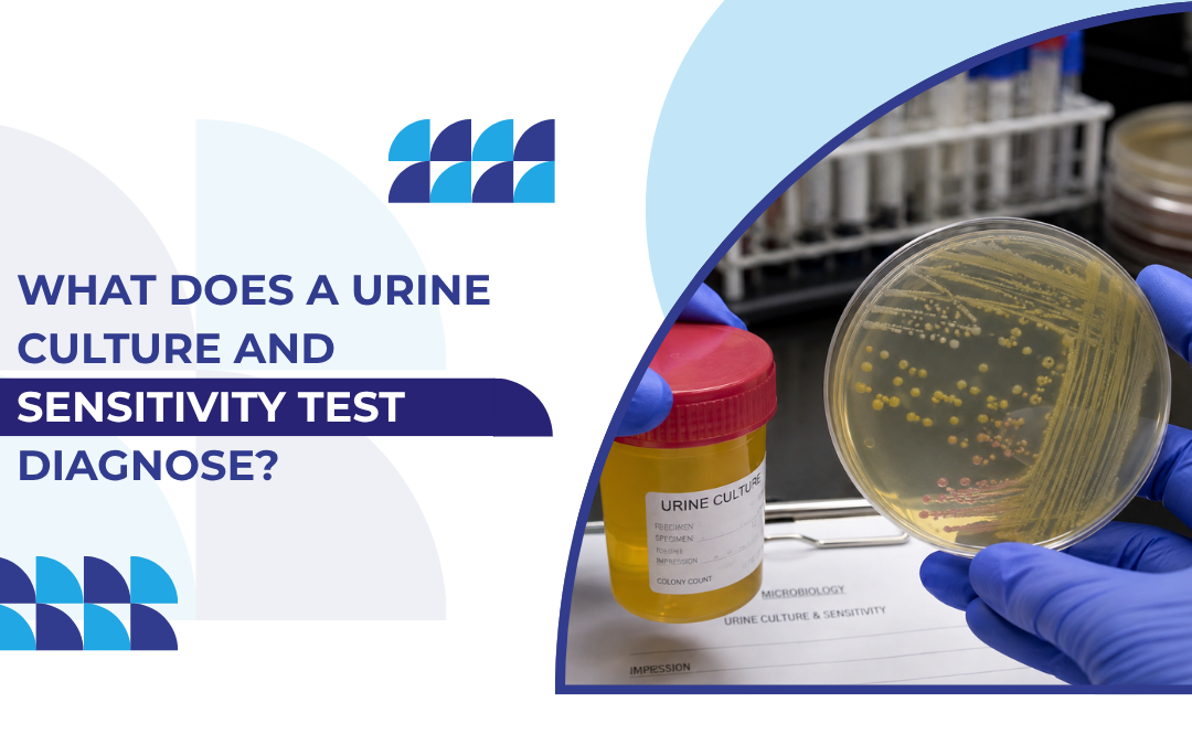 What Does a Urine Culture and Sensitivity Test Diagnose