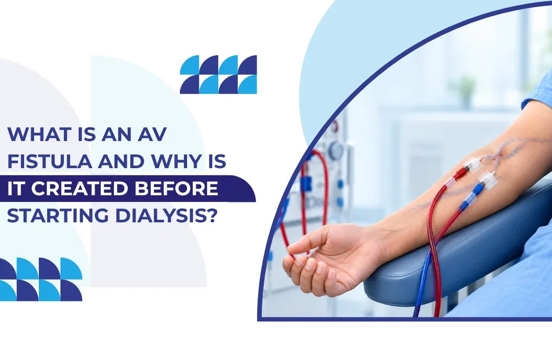 What Is an AV Fistula and Why Is It Created Before Starting Dialysis