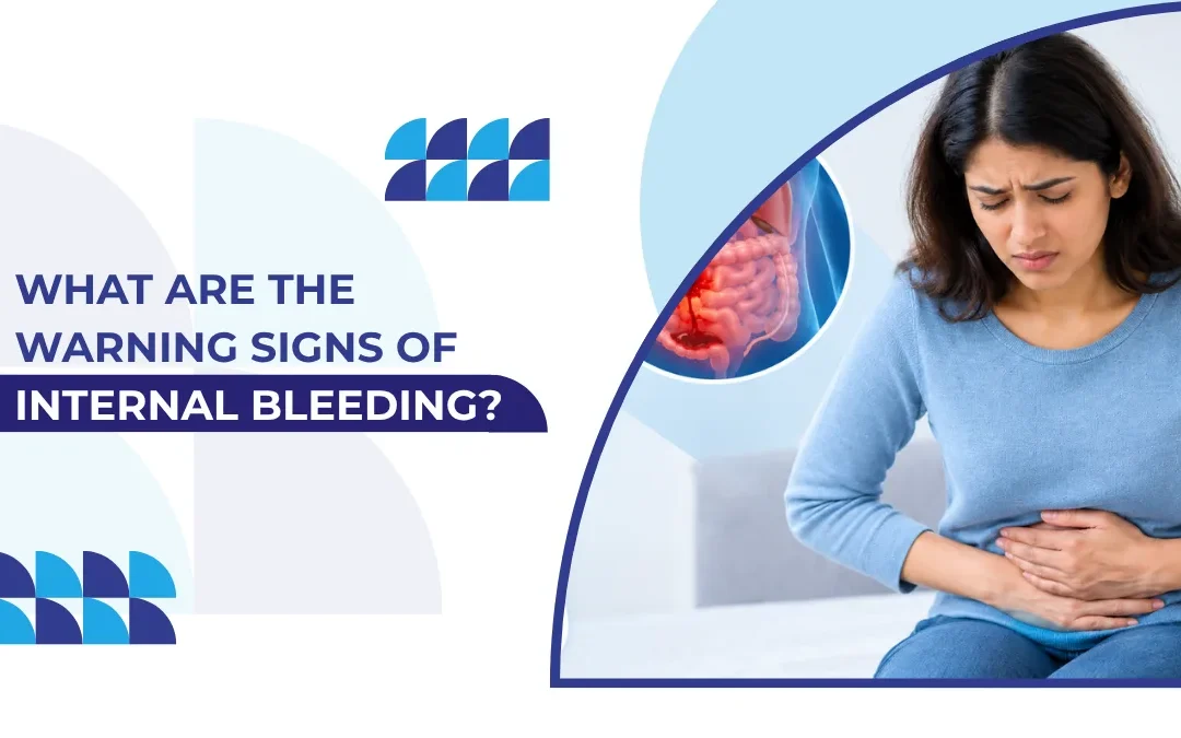 What Are the Warning Signs of Internal Bleeding?