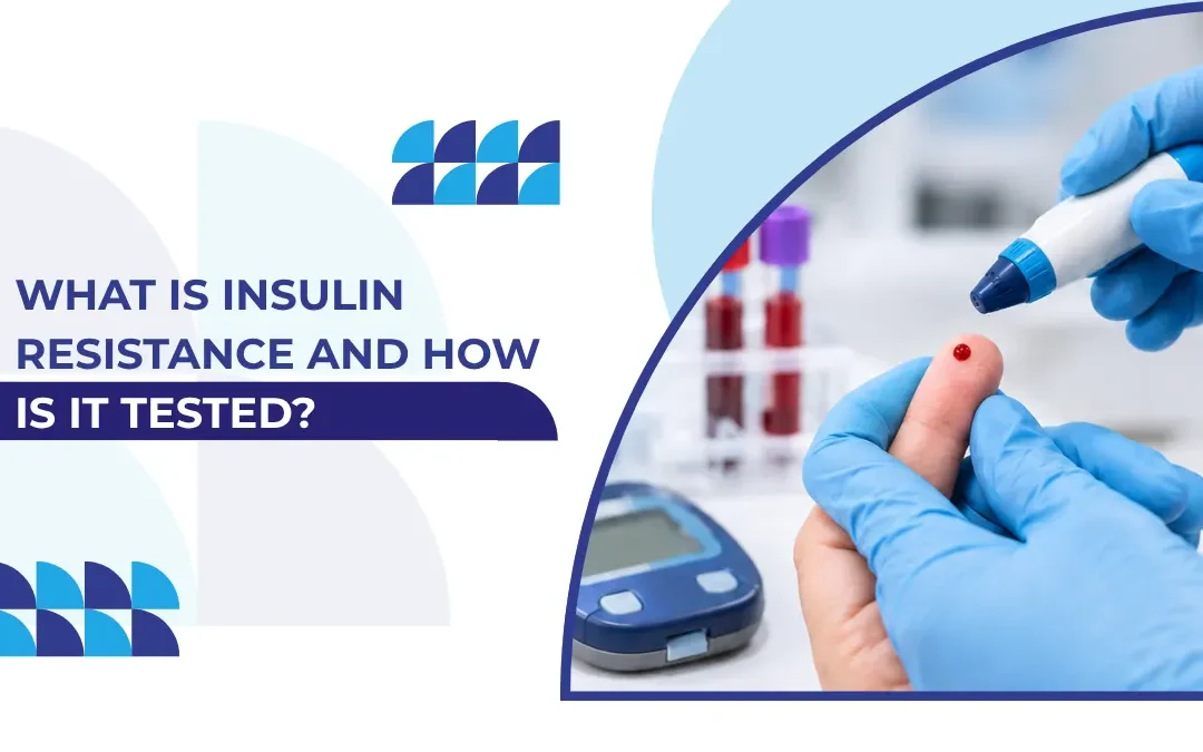 What Is Insulin Resistance and How Is It Tested
