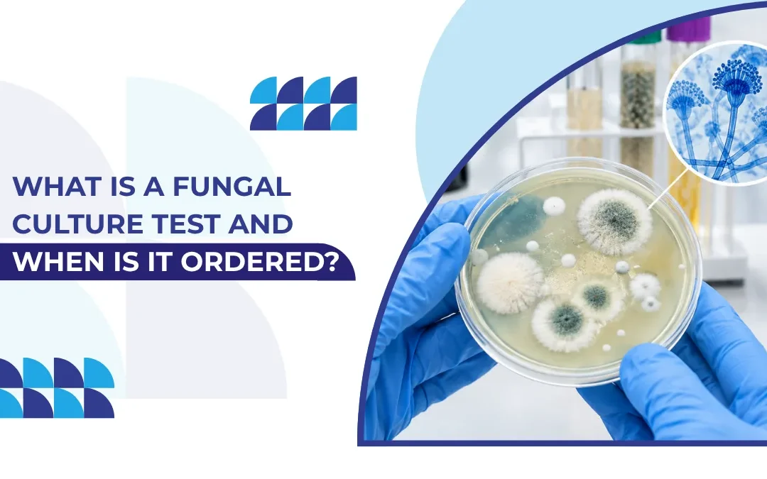 What Is a Fungal Culture Test and When Is It Ordered?