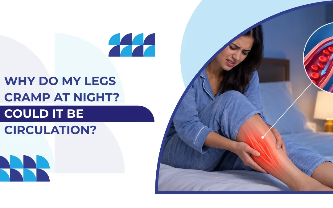 Why Do My Legs Cramp at Night? Could It Be Circulation?