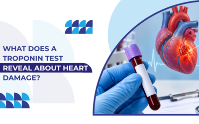 What Does a Troponin Test Reveal About Heart Damage?