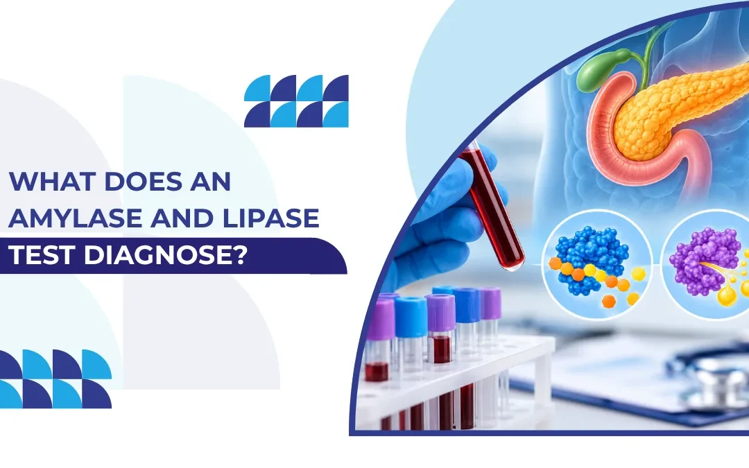 What Does an Amylase and Lipase Test Diagnose?