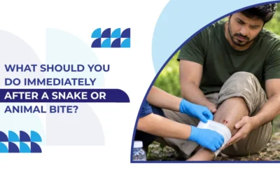 What Should You Do Immediately After a Snake or Animal Bite?